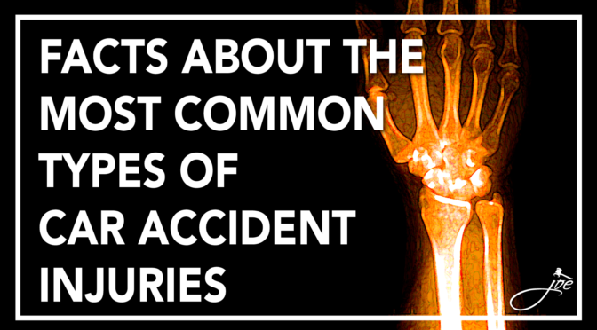 Facts About the Most Common Types of Car Accident Injuries.