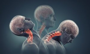 transparent image of person suffering whiplash and the cervical strain caused by an auto accident