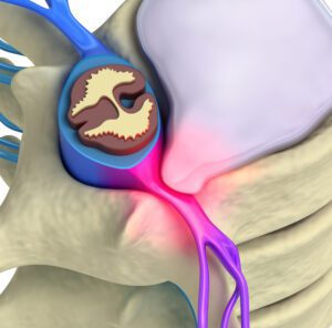 sectional view of spinal column