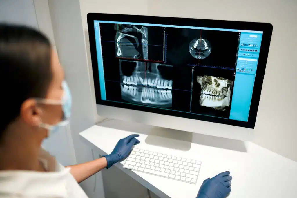 Dental healthcare provider reviewing a patient's x-rays